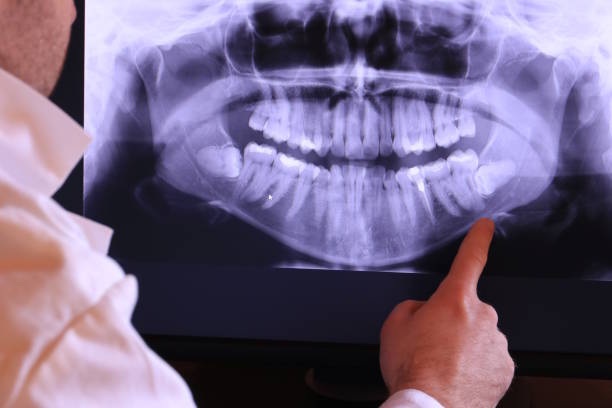Best Emergency Dentist for Special Needs Patients in Dandridge, TN