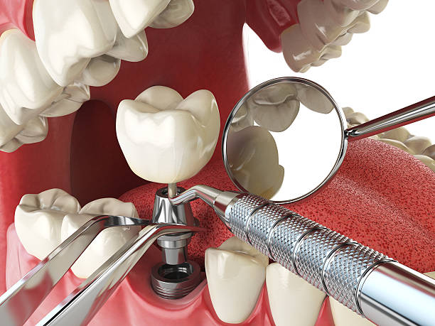 Best Holiday Emergency Dentist in Dandridge, TN